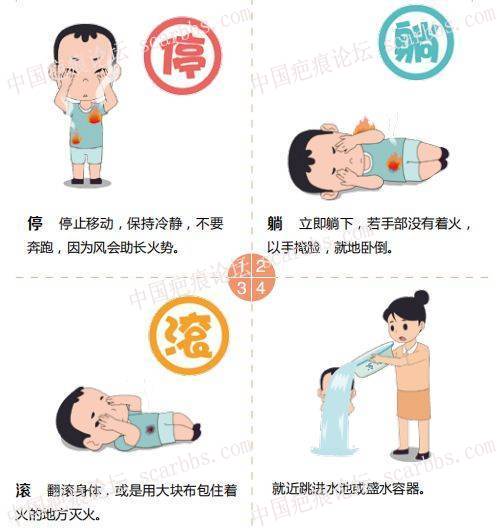 身上着火如何自救 