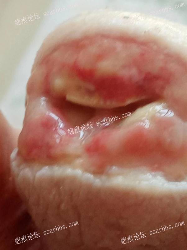 李高令面对（志愿者）有时显的自己很无奈…（青岛） 