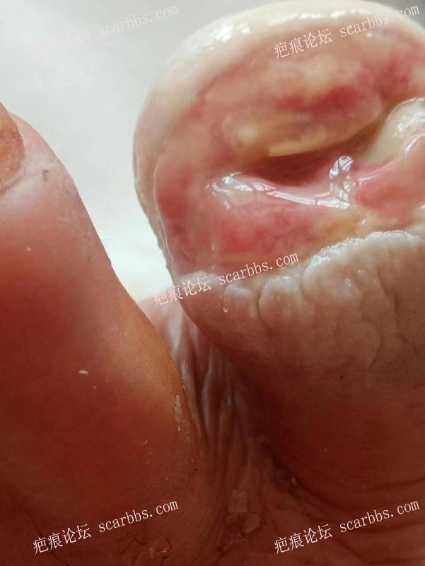 李高令面对（志愿者）有时显的自己很无奈…（青岛） 