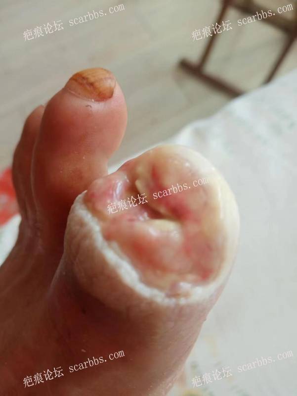 李高令面对（志愿者）有时显的自己很无奈…（青岛） 