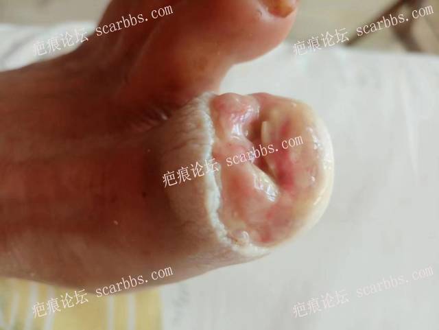 李高令面对（志愿者）有时显的自己很无奈…（青岛） 