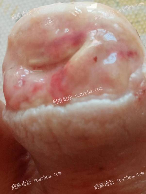 李高令面对（志愿者）有时显的自己很无奈…（青岛） 