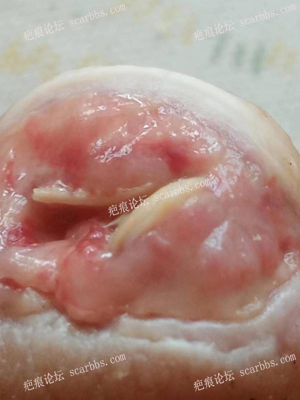 李高令面对（志愿者）有时显的自己很无奈…（青岛） 