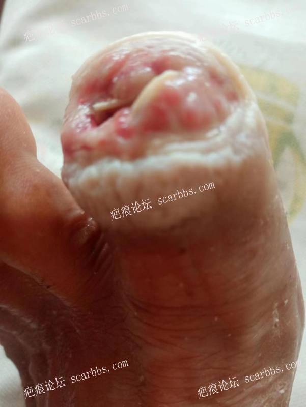 李高令面对（志愿者）有时显的自己很无奈…（青岛） 