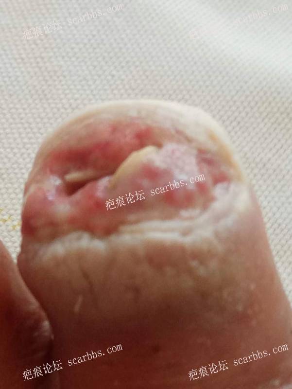 李高令面对（志愿者）有时显的自己很无奈…（青岛） 