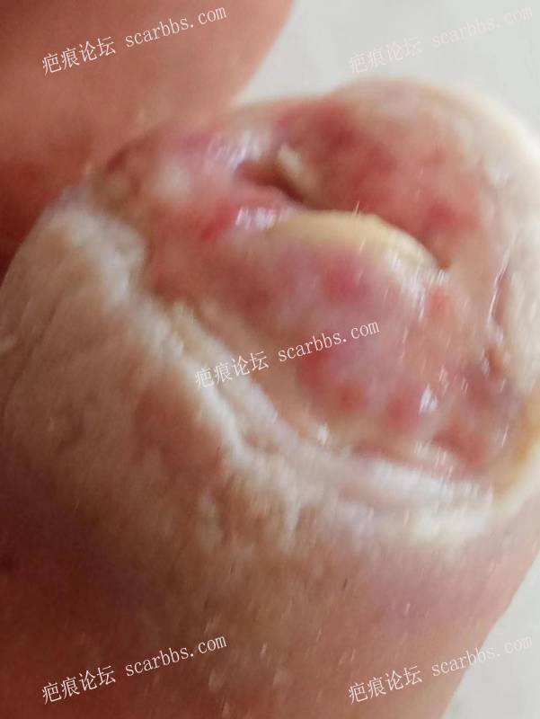 李高令面对（志愿者）有时显的自己很无奈…（青岛） 