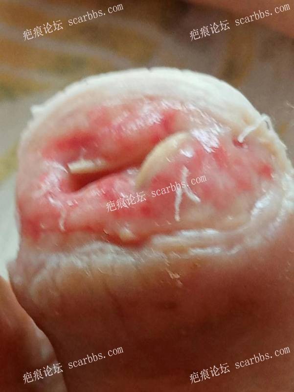 李高令面对（志愿者）有时显的自己很无奈…（青岛） 