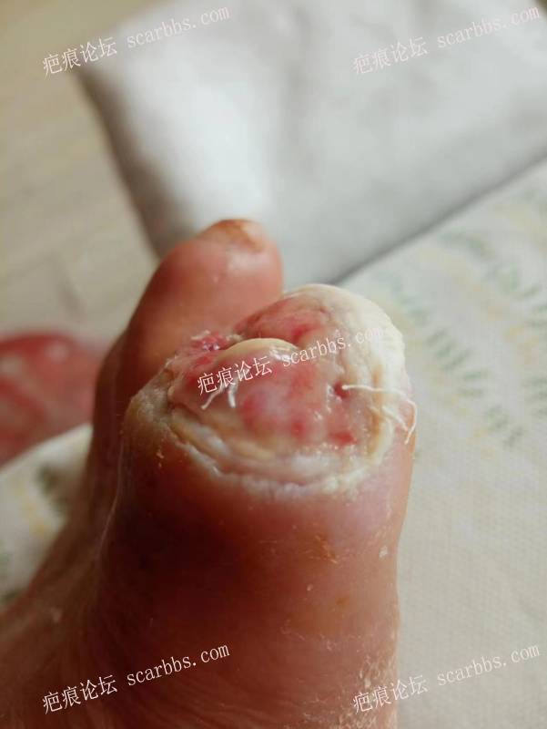 李高令面对（志愿者）有时显的自己很无奈…（青岛） 