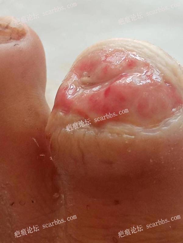 李高令面对（志愿者）有时显的自己很无奈…（青岛） 