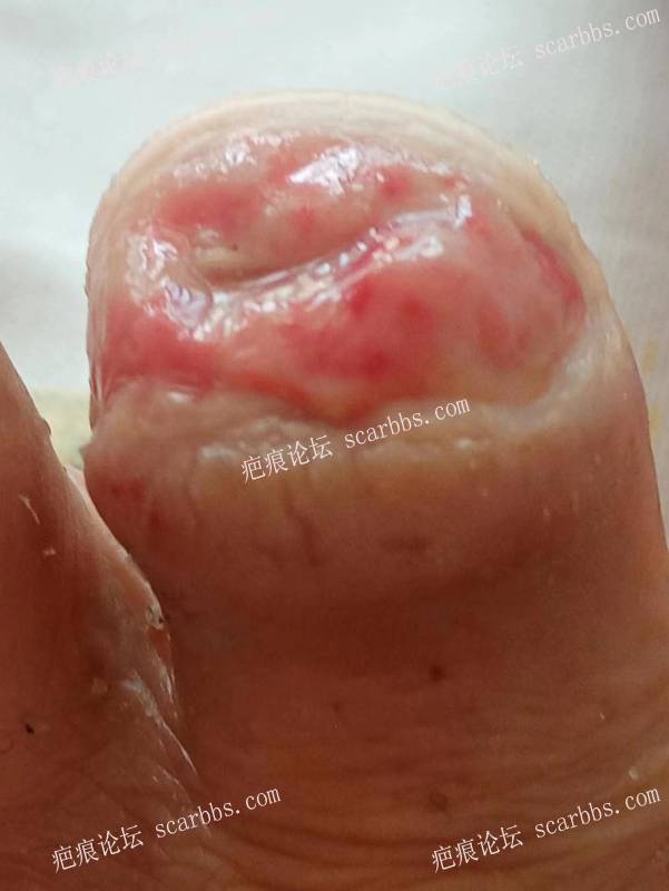 李高令面对（志愿者）有时显的自己很无奈…（青岛） 