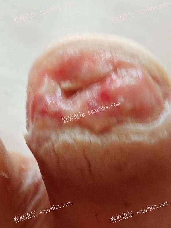 李高令面对（志愿者）有时显的自己很无奈…（青岛） 