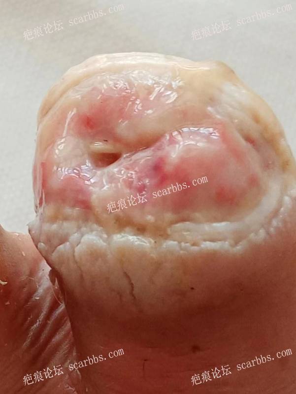 李高令面对（志愿者）有时显的自己很无奈…（青岛） 