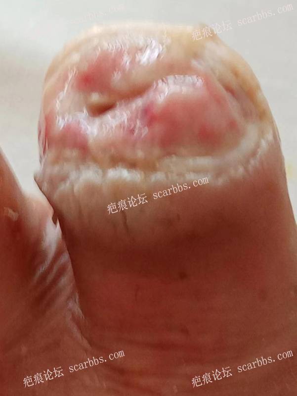李高令面对（志愿者）有时显的自己很无奈…（青岛） 