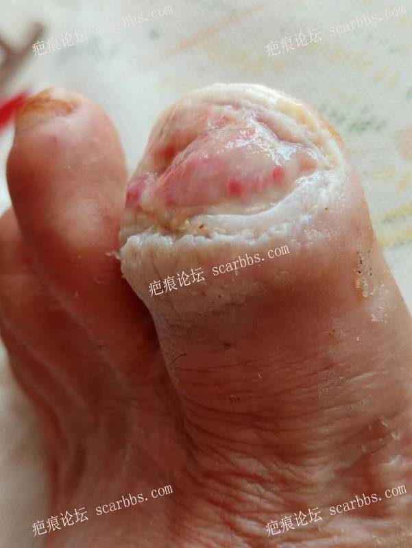 李高令面对（志愿者）有时显的自己很无奈…（青岛） 