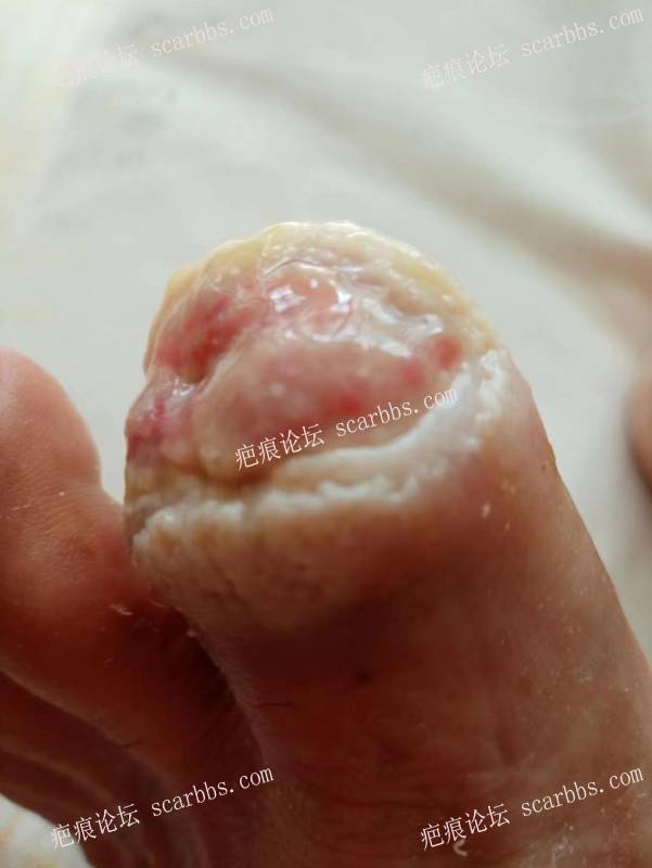 李高令面对（志愿者）有时显的自己很无奈…（青岛） 