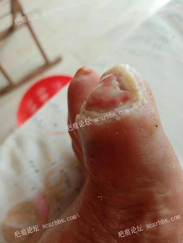 李高令面对（志愿者）有时显的自己很无奈…（青岛） 