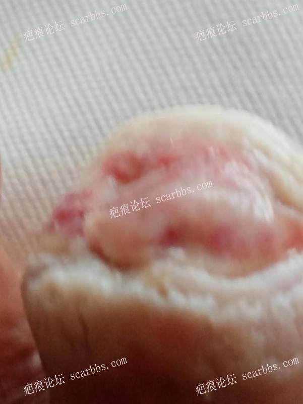 李高令面对（志愿者）有时显的自己很无奈…（青岛） 