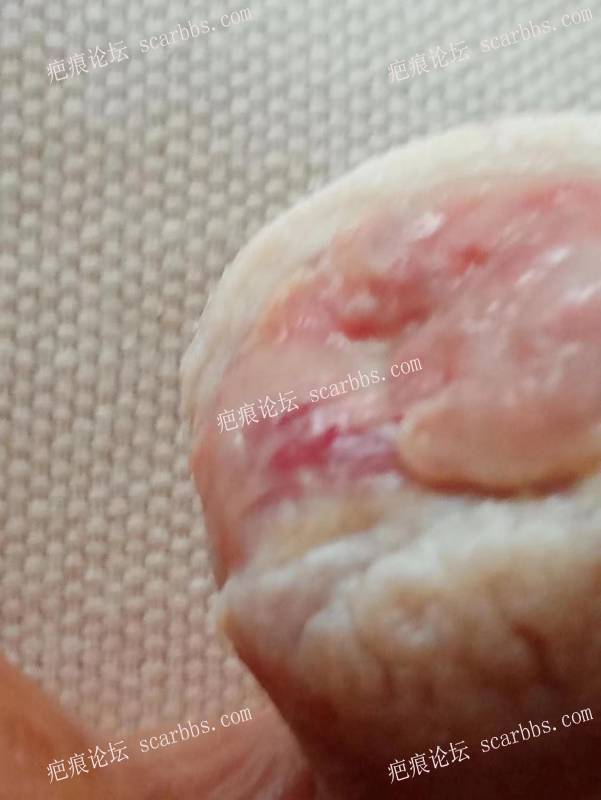李高令面对（志愿者）有时显的自己很无奈…（青岛） 