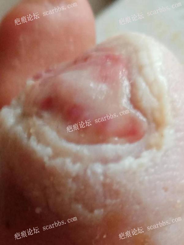 李高令面对（志愿者）有时显的自己很无奈…（青岛） 