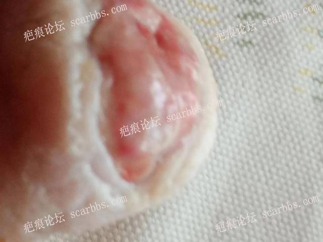 李高令面对（志愿者）有时显的自己很无奈…（青岛） 