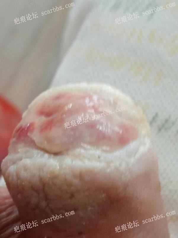 李高令面对（志愿者）有时显的自己很无奈…（青岛） 