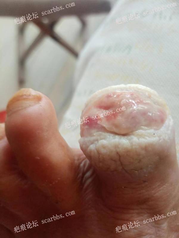 李高令面对（志愿者）有时显的自己很无奈…（青岛） 