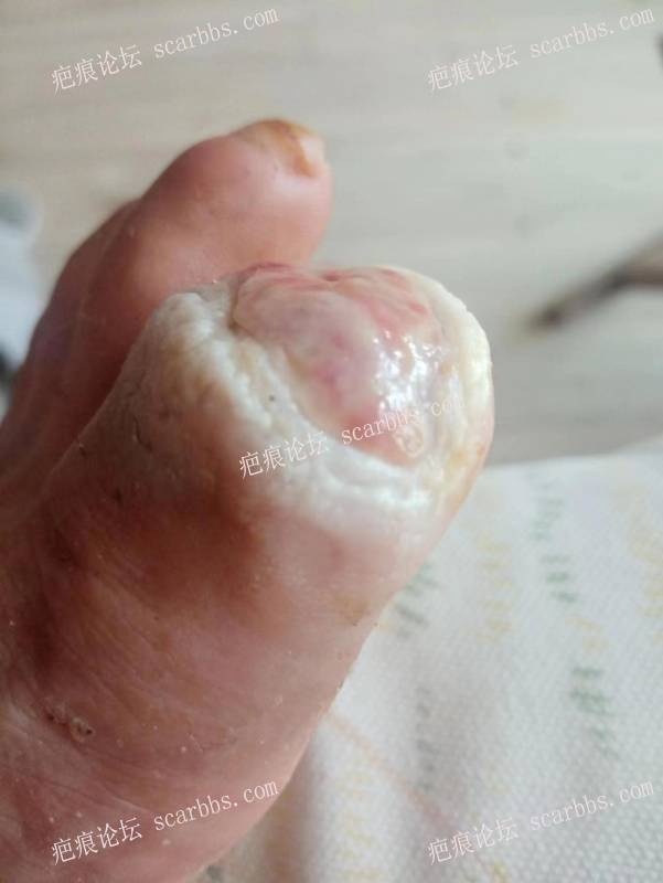 李高令面对（志愿者）有时显的自己很无奈…（青岛） 