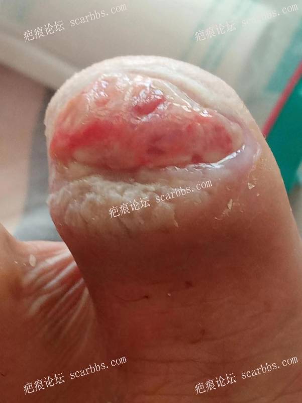 李高令面对（志愿者）有时显的自己很无奈…（青岛） 