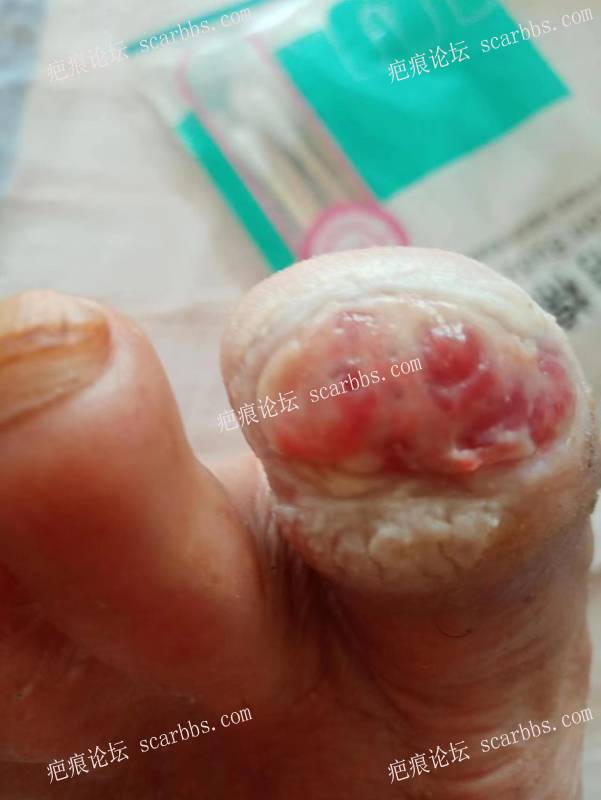 李高令面对（志愿者）有时显的自己很无奈…（青岛） 