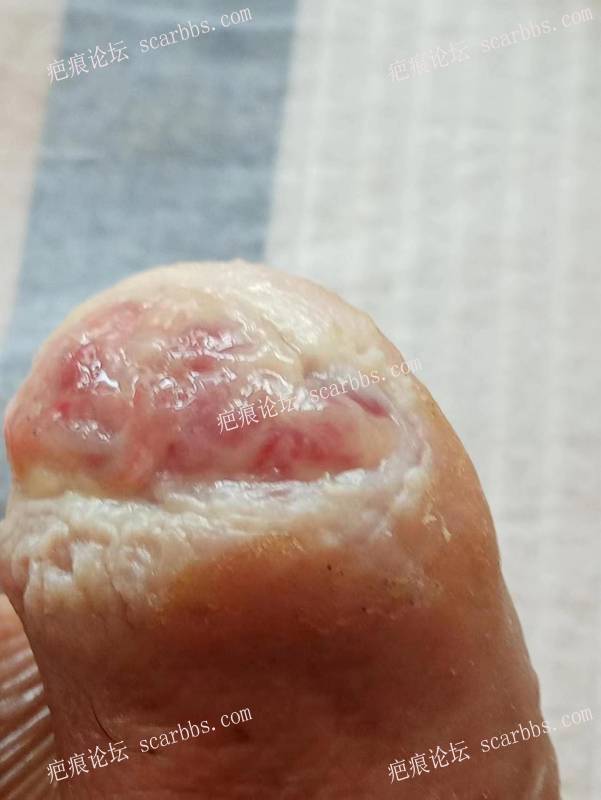 李高令面对（志愿者）有时显的自己很无奈…（青岛） 
