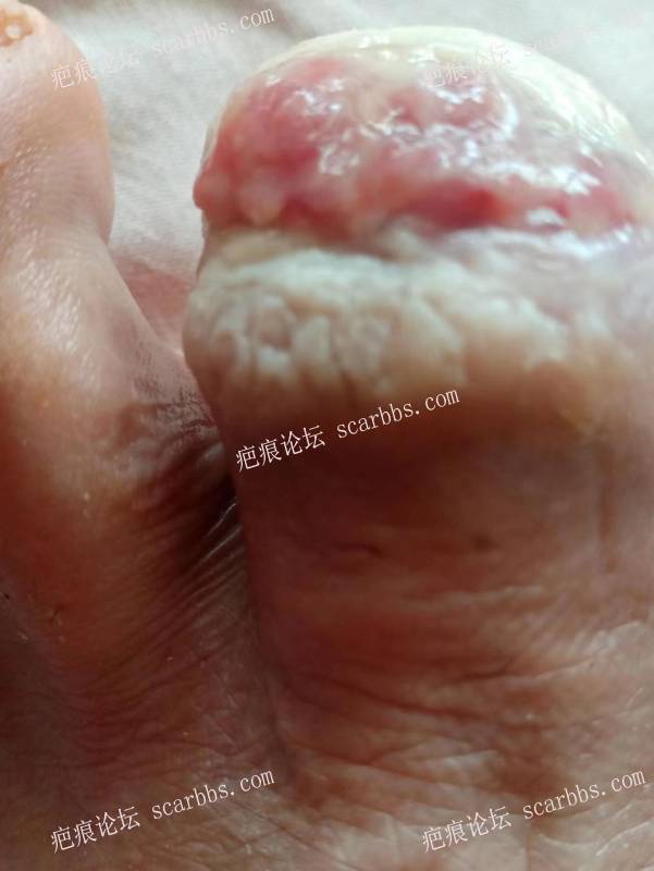 李高令面对（志愿者）有时显的自己很无奈…（青岛） 