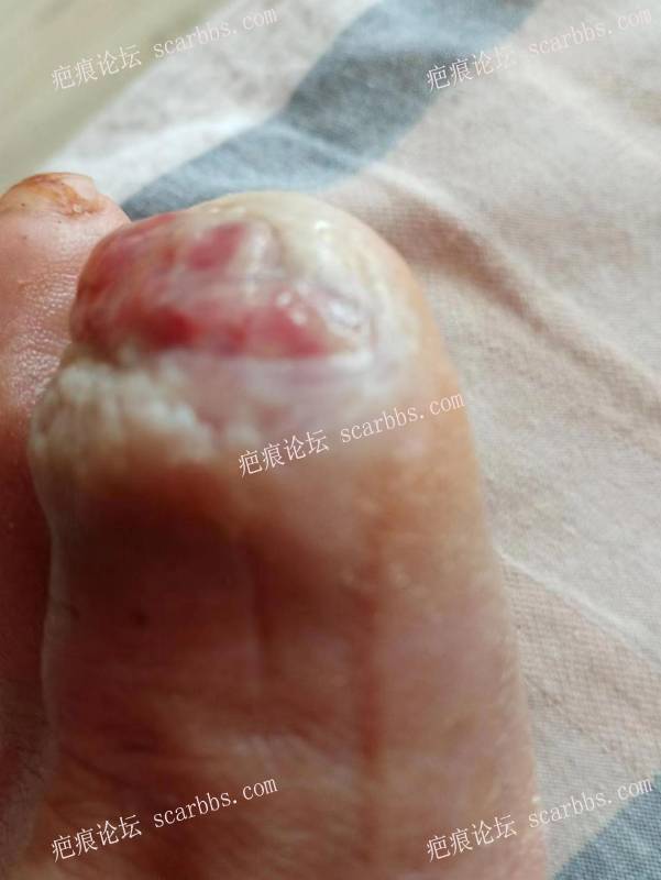 李高令面对（志愿者）有时显的自己很无奈…（青岛） 