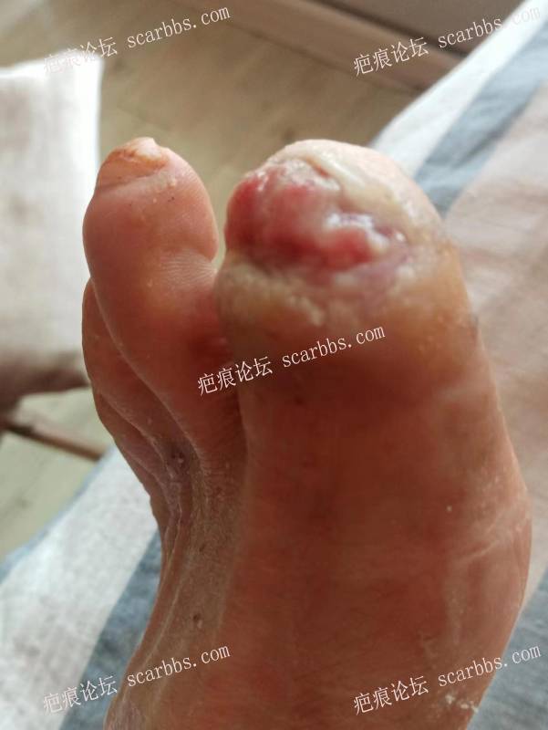 李高令面对（志愿者）有时显的自己很无奈…（青岛） 