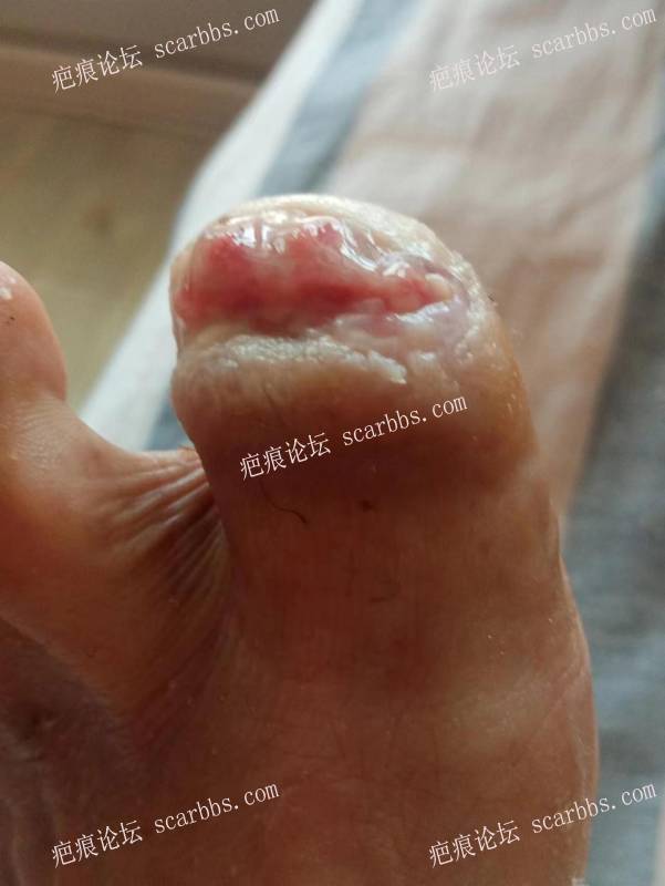 李高令面对（志愿者）有时显的自己很无奈…（青岛） 