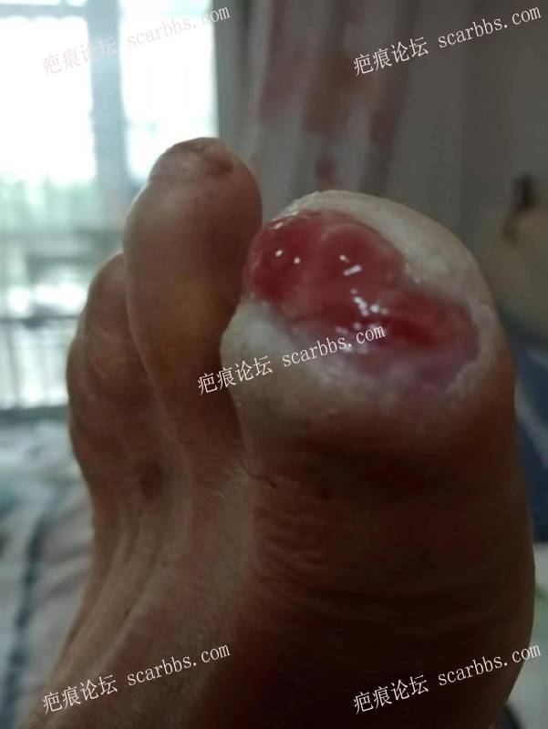 李高令面对（志愿者）有时显的自己很无奈…（青岛） 