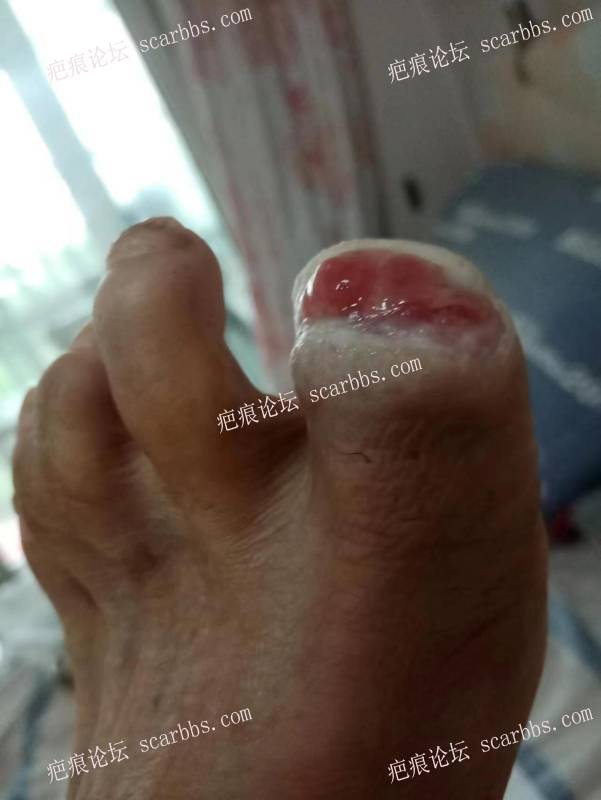 李高令面对（志愿者）有时显的自己很无奈…（青岛） 