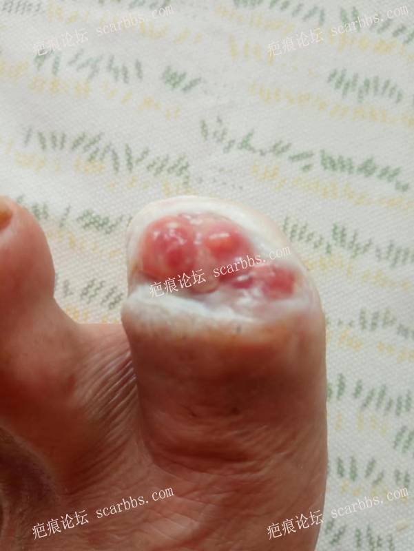 李高令面对（志愿者）有时显的自己很无奈…（青岛） 
