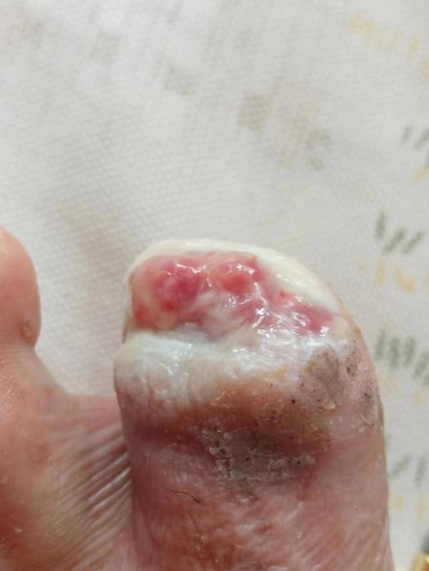 李高令面对（志愿者）有时显的自己很无奈…（青岛） 