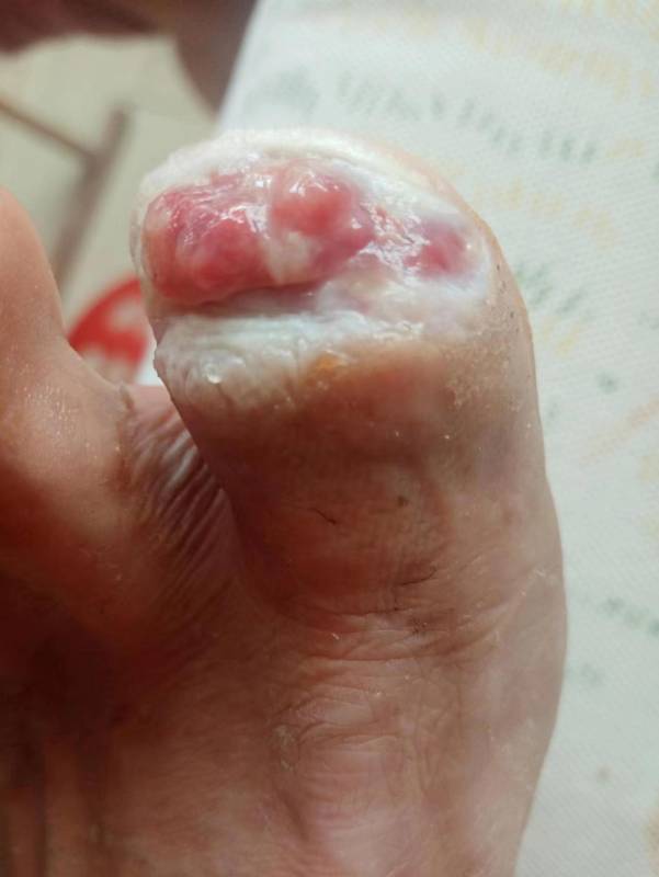 李高令面对（志愿者）有时显的自己很无奈…（青岛） 