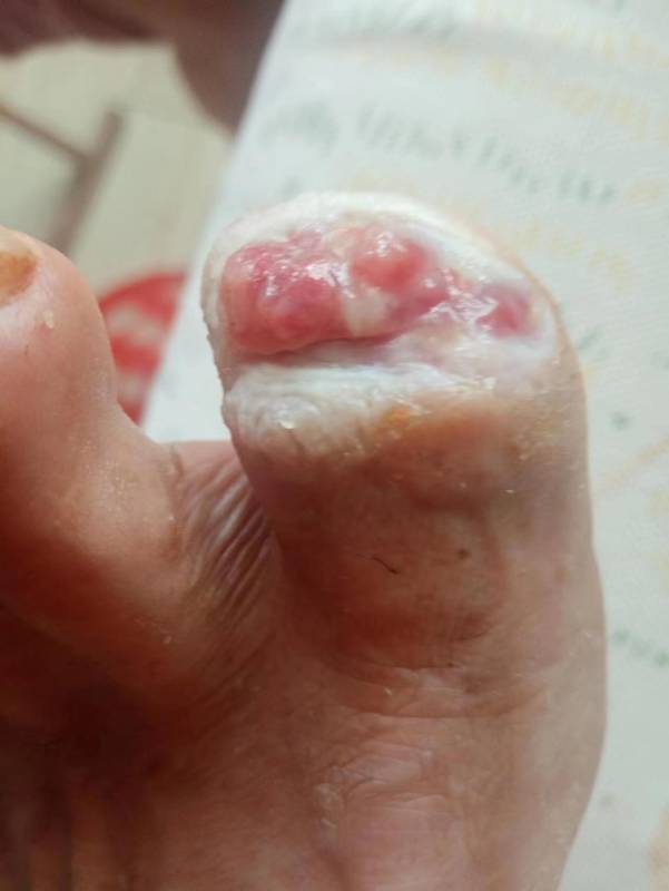 李高令面对（志愿者）有时显的自己很无奈…（青岛） 