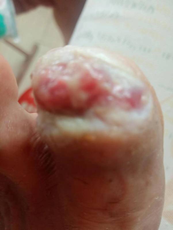 李高令面对（志愿者）有时显的自己很无奈…（青岛） 
