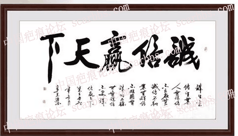 女儿烫伤在青岛大康烧烫伤医院治疗恢复得很好 青岛大康烧烫伤医院