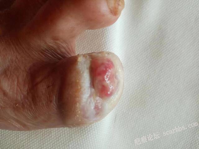 李高令面对（志愿者）有时显的自己很无奈…（青岛） 