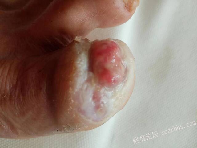 李高令面对（志愿者）有时显的自己很无奈…（青岛） 
