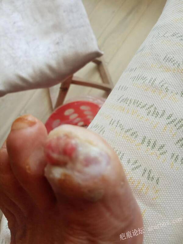 李高令面对（志愿者）有时显的自己很无奈…（青岛） 