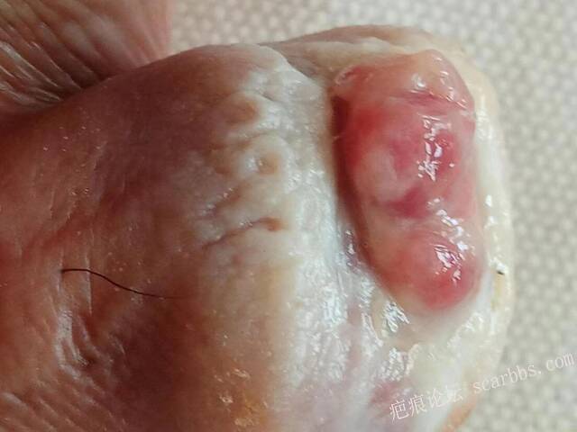 李高令面对（志愿者）有时显的自己很无奈…（青岛） 