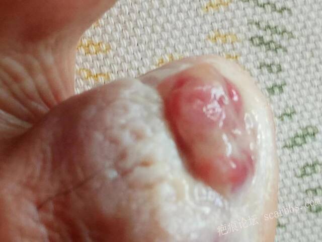 李高令面对（志愿者）有时显的自己很无奈…（青岛） 