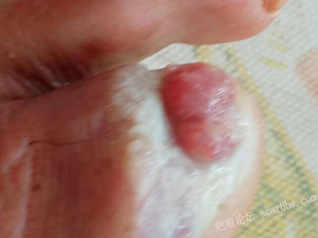 李高令面对（志愿者）有时显的自己很无奈…（青岛） 