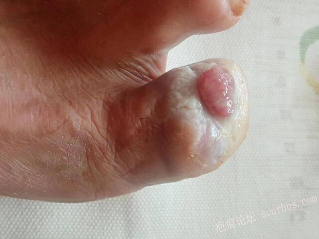 李高令面对（志愿者）有时显的自己很无奈…（青岛） 