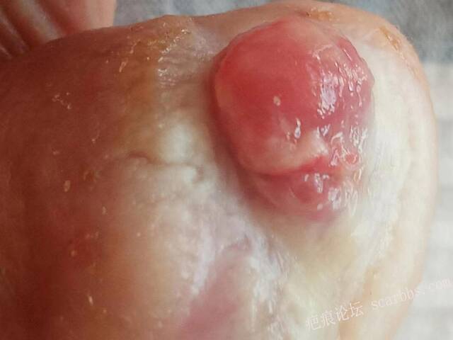 李高令面对（志愿者）有时显的自己很无奈…（青岛） 